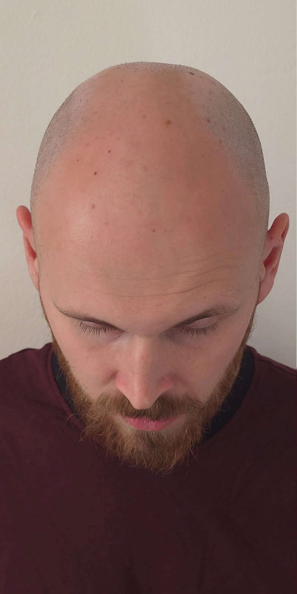 Před